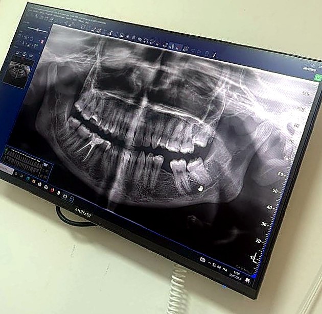 Radiographie panoramique numérique réalisée au centre